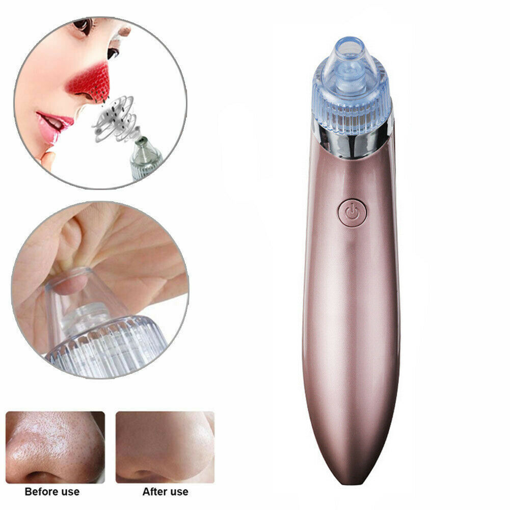 Emporium Pore Vacuum Suction Cleaner | Electric Blackhead & Pimple Remover for Smooth Skin