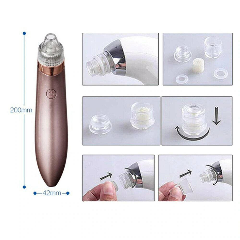 Emporium Pore Vacuum Suction Cleaner | Electric Blackhead & Pimple Remover for Smooth Skin