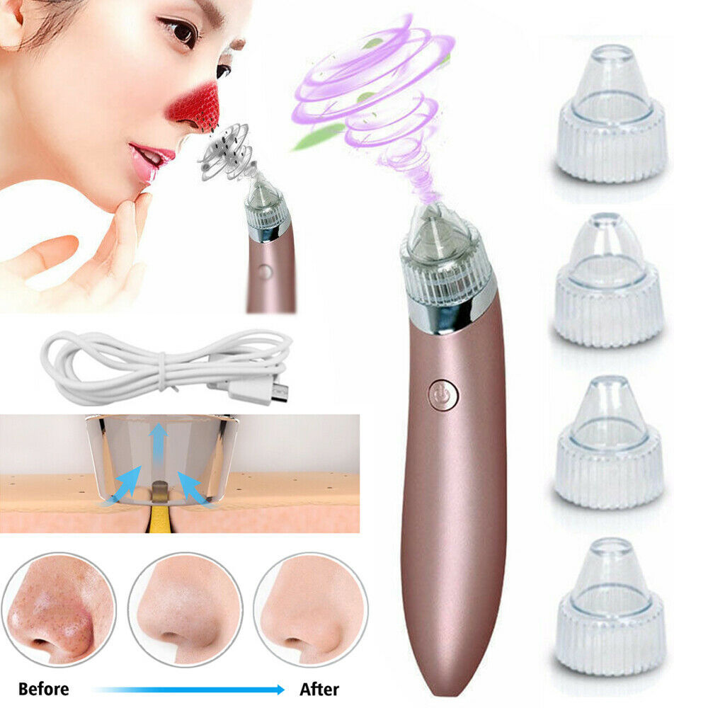 Emporium Pore Vacuum Suction Cleaner | Electric Blackhead & Pimple Remover for Smooth Skin